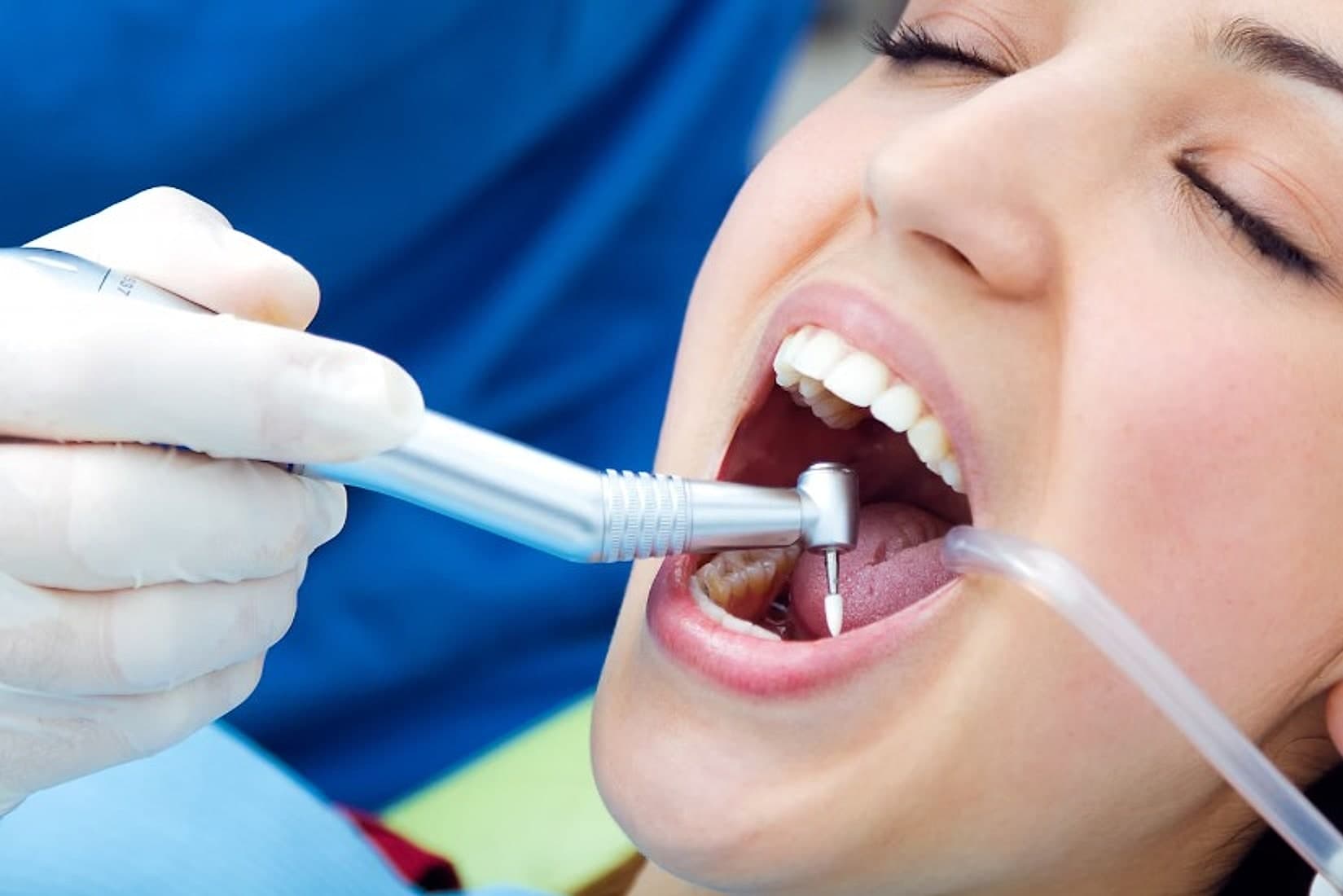 Paciente recibiendo tratamiento de endodoncia con instrumentos rotatorios